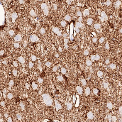 NDRG2 Recombinant Rabbit mAb (S-618-76)