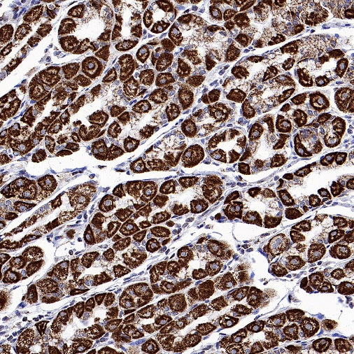 Parkin Rabbit Polyclonal Antibody