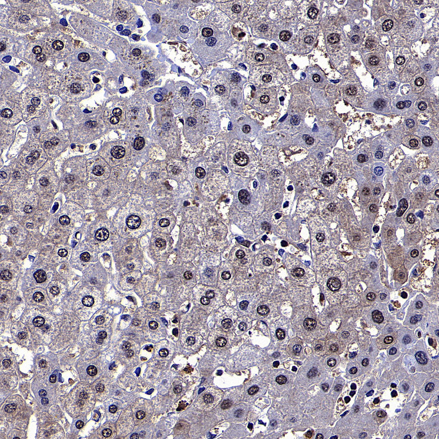 PGK1 Mouse mAb