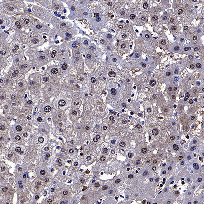 PGK1 Mouse mAb