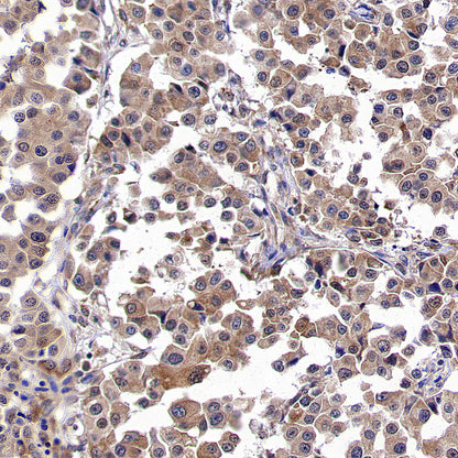 WSB1 Recombinant Rabbit mAb (S-3505-23)