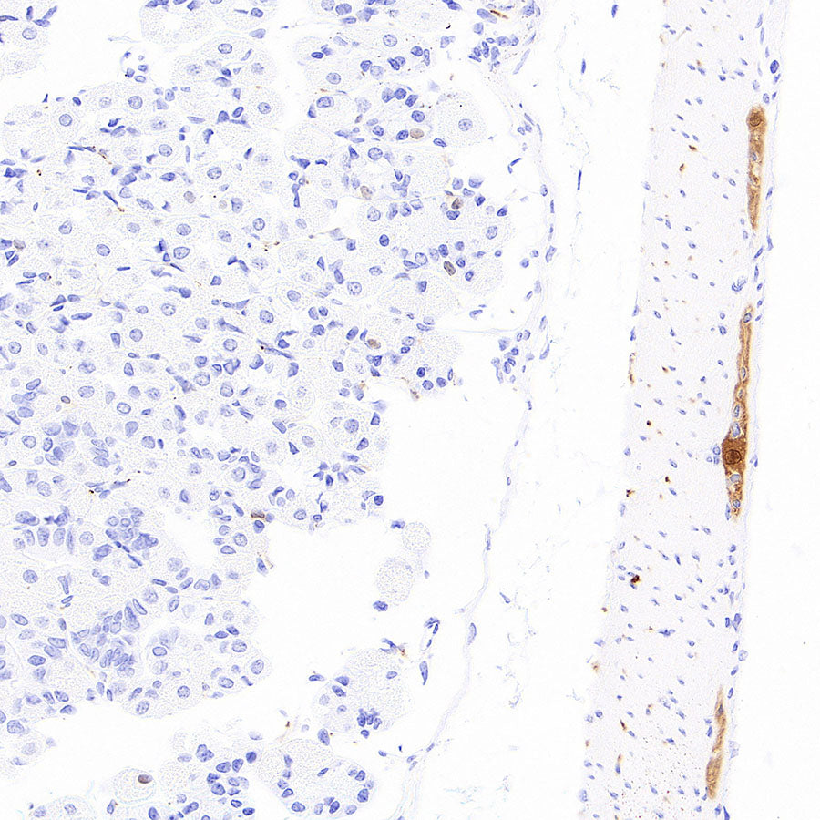 PGP9.5 Recombinant Mouse mAb (S-6071)