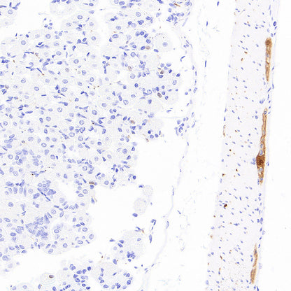 PGP9.5 Recombinant Mouse mAb (S-6071)