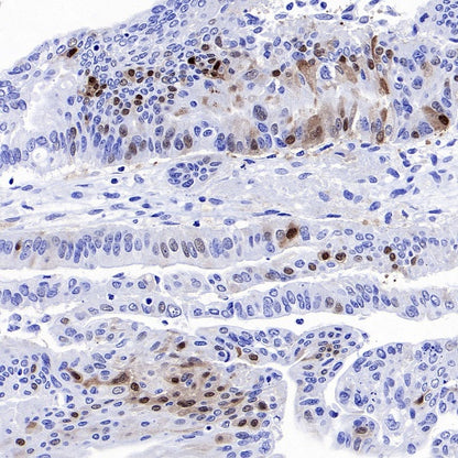 CA2 Rabbit Polyclonal Antibody