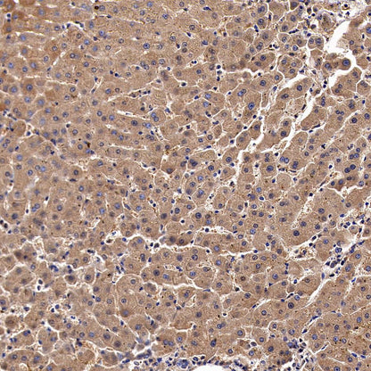 Sec61B Rabbit Polyclonal Antibody