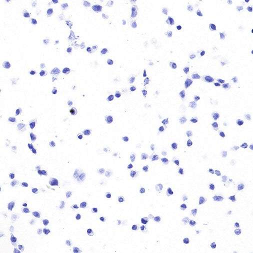 STEAP3 Recombinant Rabbit mAb (S-4466-26)