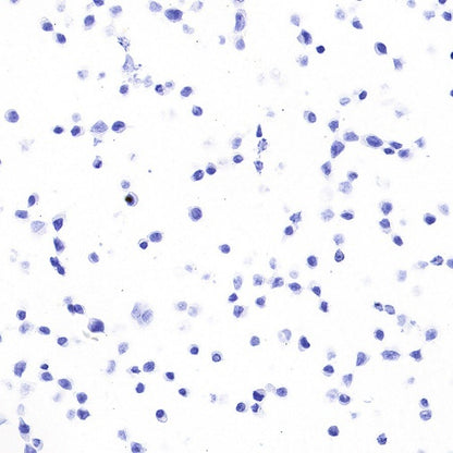 STEAP3 Recombinant Rabbit mAb (S-4466-26)