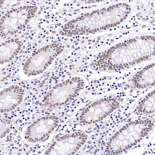 EHMT2/G9A Recombinant Rabbit mAb (S-4200)