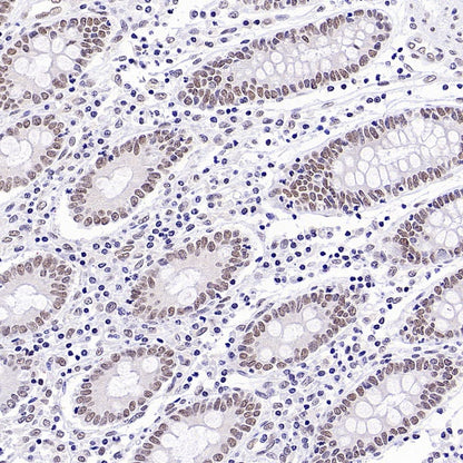 EHMT2/G9A Recombinant Rabbit mAb (S-4200)