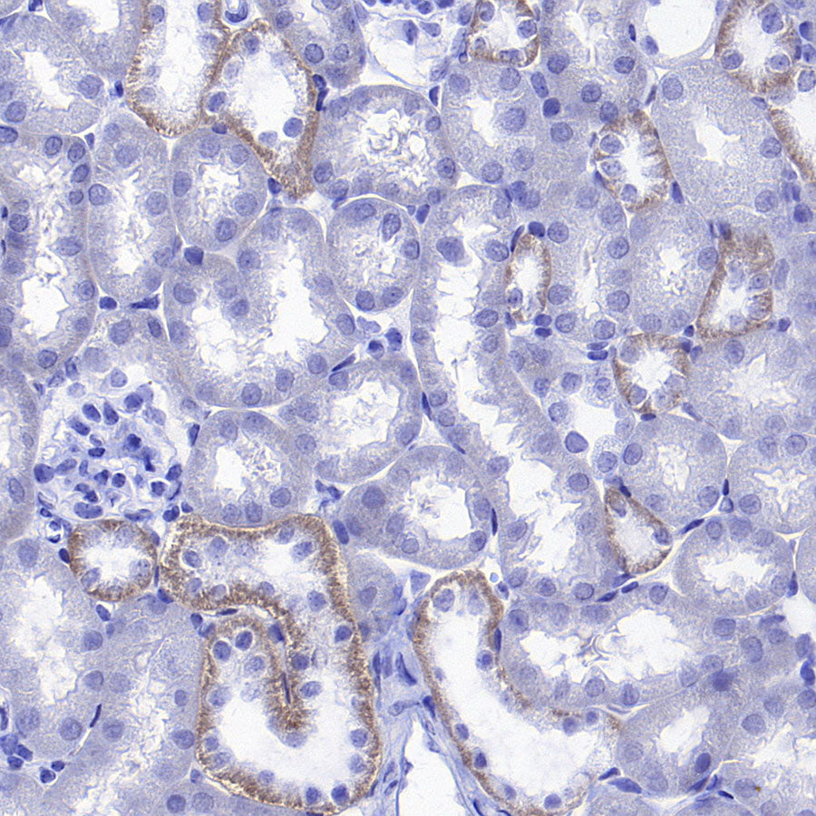ATP1B1 Rabbit Polyclonal Antibody