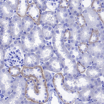 ATP1B1 Rabbit Polyclonal Antibody