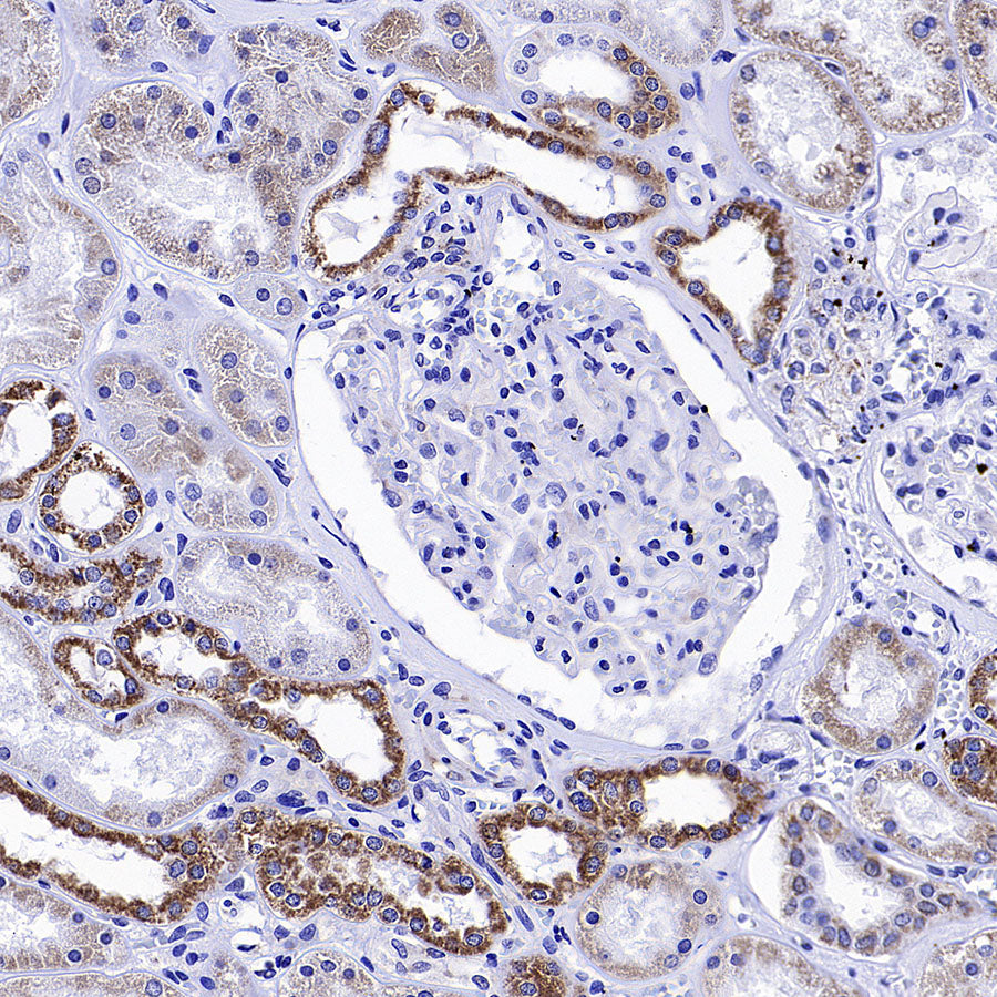 NDUFA9 Recombinant Mouse mAb (S-5382)