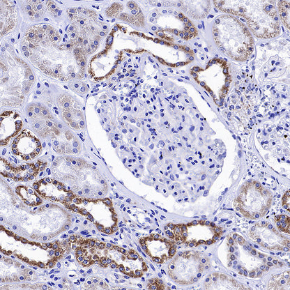 NDUFA9 Recombinant Mouse mAb (S-5382)