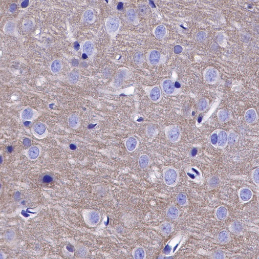 TrkB Recombinant Rabbit mAb (S-488-5)