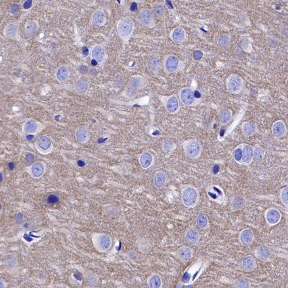 TrkB Recombinant Rabbit mAb (S-488-5)
