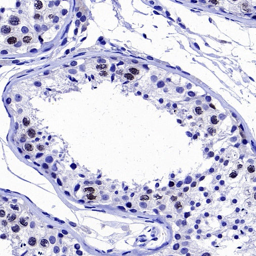 Survivin Recombinant Rabbit mAb (S-2334-26)