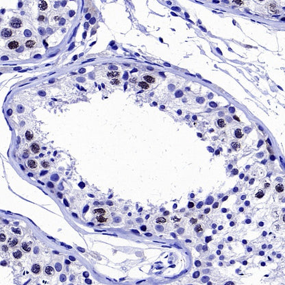 Survivin Recombinant Rabbit mAb (S-2334-26)