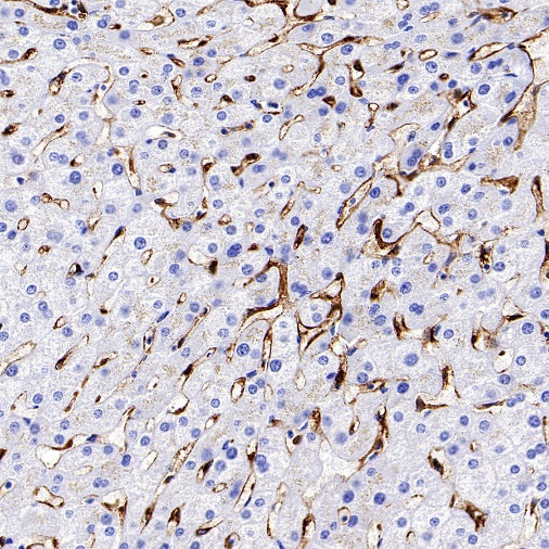 Mannose Receptor Recombinant Rabbit mAb (SDT-2206-52)