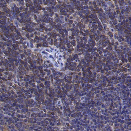 Caspase-8 Recombinant Rabbit mAb (S-2676-121)