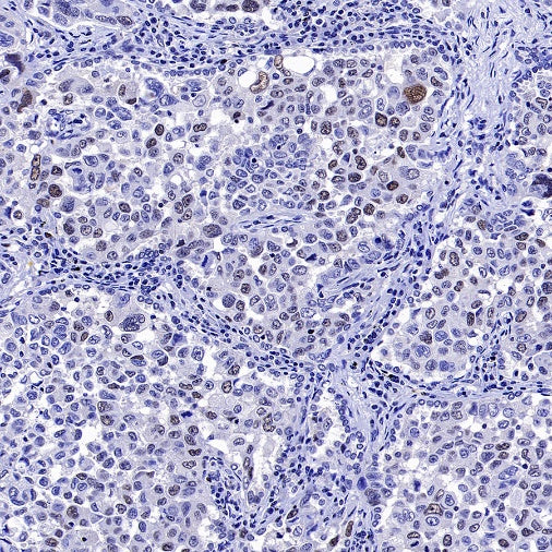 Phospho-NAK/TBK1 (Ser172) Recombinant Rabbit mAb (S-3182)