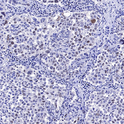Phospho-NAK/TBK1 (Ser172) Recombinant Rabbit mAb (S-3182)