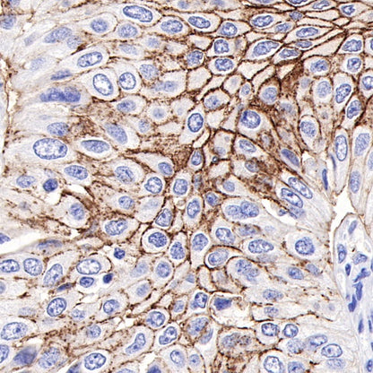 Claudin 4 Recombinant Rabbit mAb (SDT-814-53)