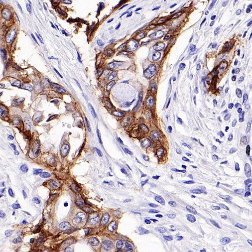 Integrin beta 6 Recombinant Rabbit mAb (SDT-1445-78)