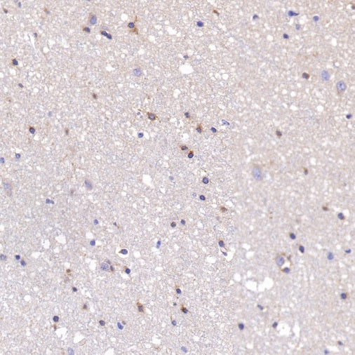 PSEN1 Recombinant Rabbit mAb (S-1002-129)
