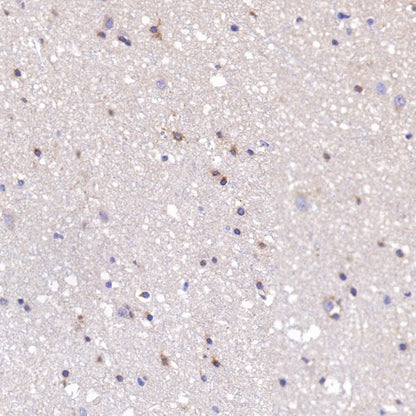 PSEN1 Recombinant Rabbit mAb (S-1002-129)