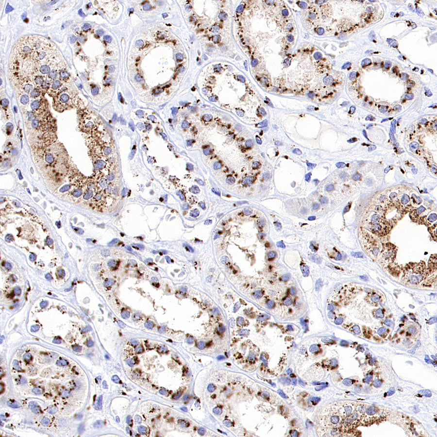 TGN46 Recombinant Rabbit mAb (S-3514-47)