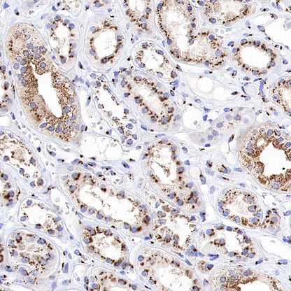 TGN46 Recombinant Rabbit mAb (S-3514-47)