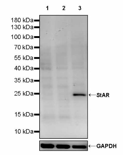 StAR Recombinant Rabbit mAb (S-2520-24)