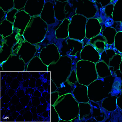 FABP4 Recombinant Rabbit mAb (S-1360-58）