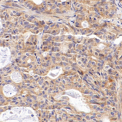 MMP2 Recombinant Rabbit mAb (S-1804-55)