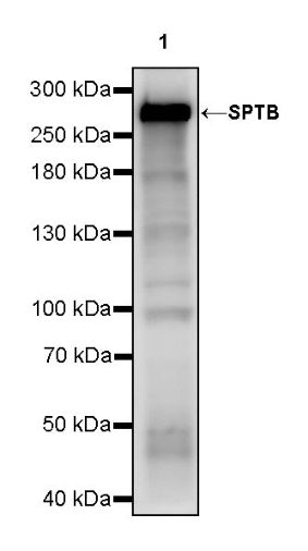SPTB Recombinant Rabbit mAb (S-755-63)