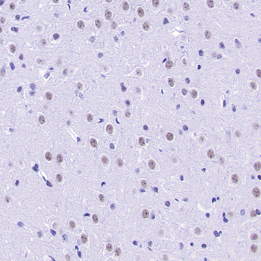 INI-1/SMARCB1 Recombinant Rabbit mAb (S-4068-21)