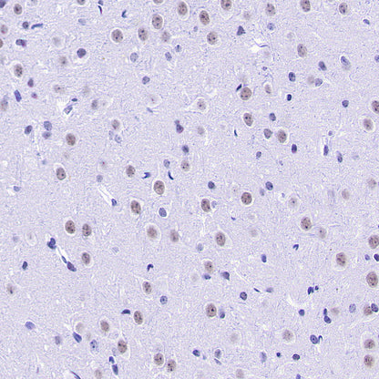 INI-1/SMARCB1 Recombinant Rabbit mAb (S-4068-21)