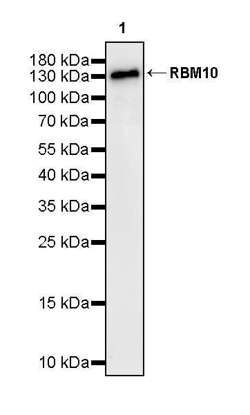 RBM10 Recombinant Rabbit mAb (S-4370-47)