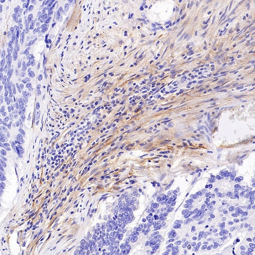 LRRC15 Recombinant Rabbit mAb (S-2473-43)