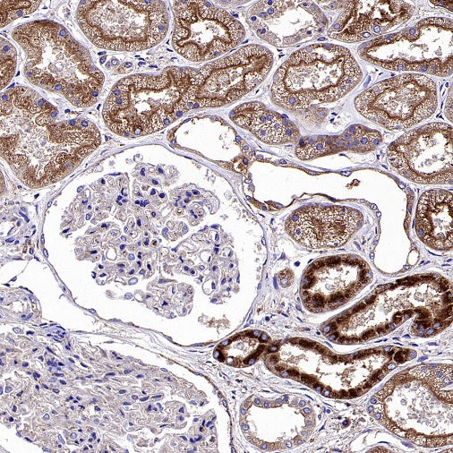 CD107b/LAMP2 Recombinant Mouse mAb (H4B4)