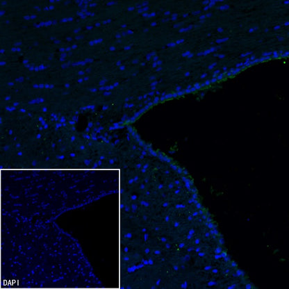 ARL13B Recombinant Rabbit mAb (S-2113-11)