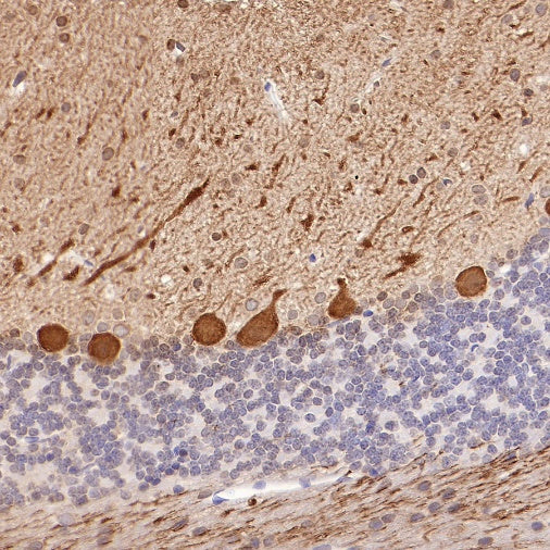 Calbindin Recombinant Rabbit mAb (S-774-378)
