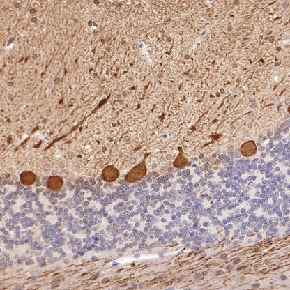 Calbindin Recombinant Rabbit mAb (S-774-378)