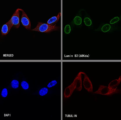S-RMab®Lamin B2 Recombinant Rabbit mAb (S-951-70)
