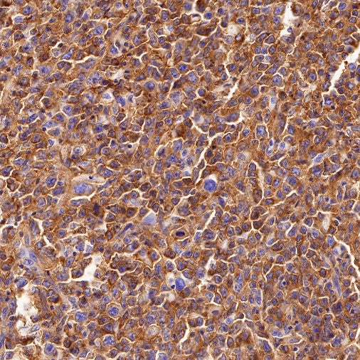 HLA-DPB1 Recombinant Rabbit mAb (S-R263)