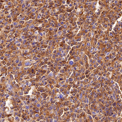 HLA-DPB1 Recombinant Rabbit mAb (S-R263)