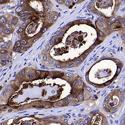 CEA Recombinant Rabbit mAb (SDT-098-63)