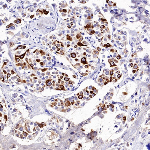 Phospho-IKKα/β (Ser176/180) Recombinant Rabbit mAb (S-4059)