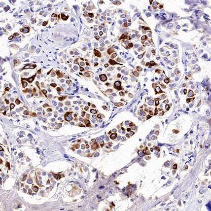 Phospho-IKKα/β (Ser176/180) Recombinant Rabbit mAb (S-4059)