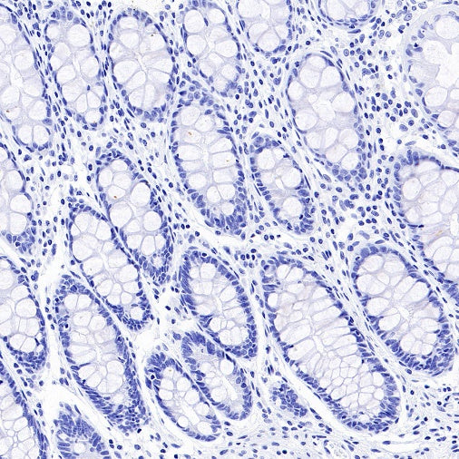 MDR3 Recombinant Rabbit mAb (SDT-1949-60)